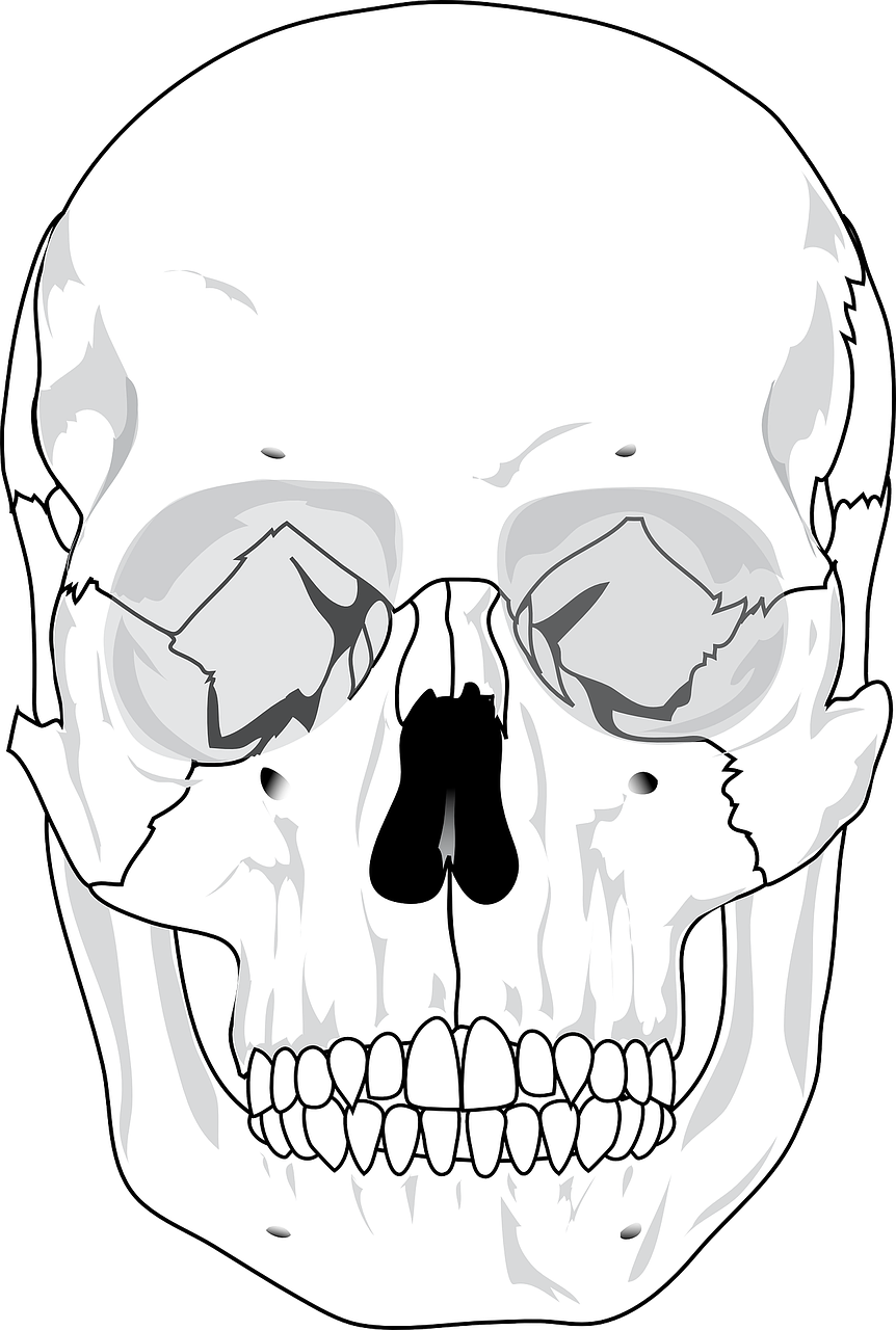 Relief Techniques for Severe Wisdom Teeth Headaches